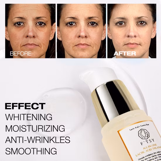 Crema aclaradora personalizada, loción corporal blanqueadora de piel instantánea con ácido kójico